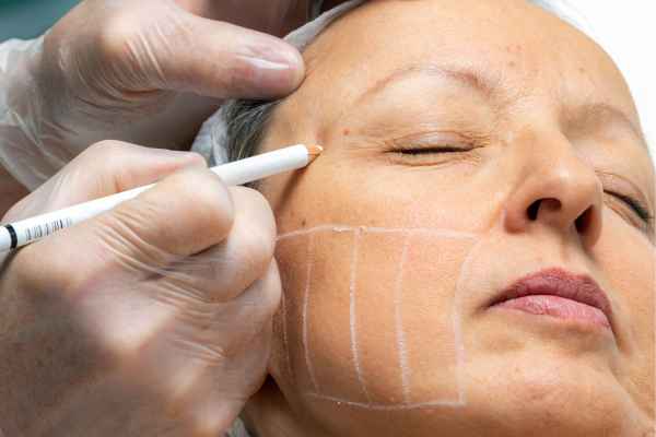 CryoPen: 5 Skin Concerns It May Be Used to Treat 4 What should you ask before having CryoPen treatment Newcastle under Lyme?