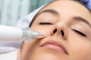 Best Actinic Keratoses Removal 3 Actinic keratoses Newcastle under Lyme solutions - book in today!
