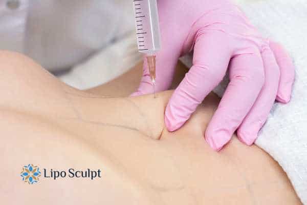 Aqualyx for Muffin Tops: What to Know Before Fat-Dissolving Injections 4 Are there risks Newcastle under Lyme?