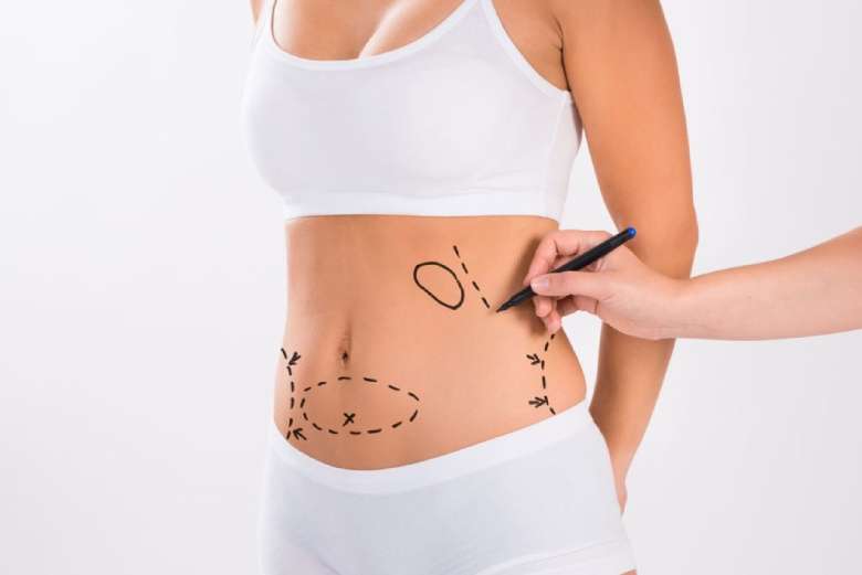 Aqualyx for Muffin Tops: What to Know Before Fat-Dissolving Injections 5 What Aqualyx cannot do