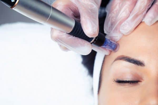Explaining Total Skin Tightening Treatment and What to Expect 2 What Skin Concerns Can Total Skin Tightening Treatment Help With Newcastle under Lyme?