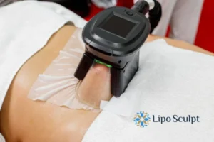 Does Fat Freezing At Home Work? 3 Fat freezing at home from Lipo Sculpt Newcastle under Lyme